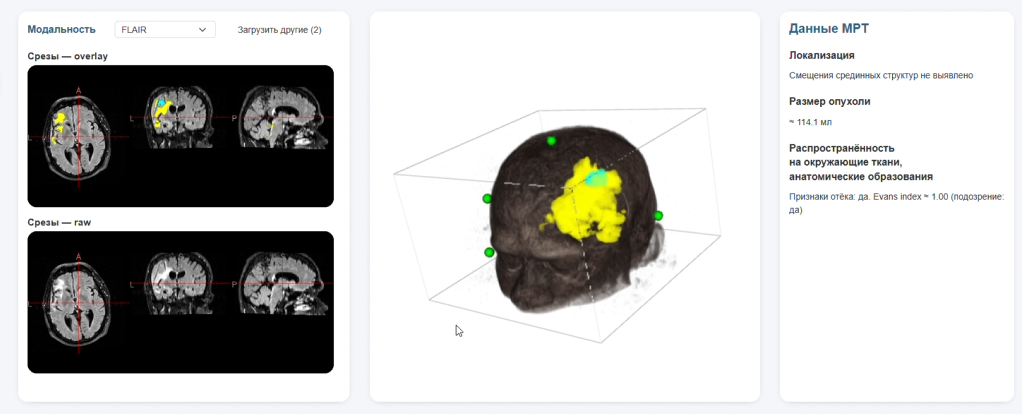 Computer Vision и Deep Learning